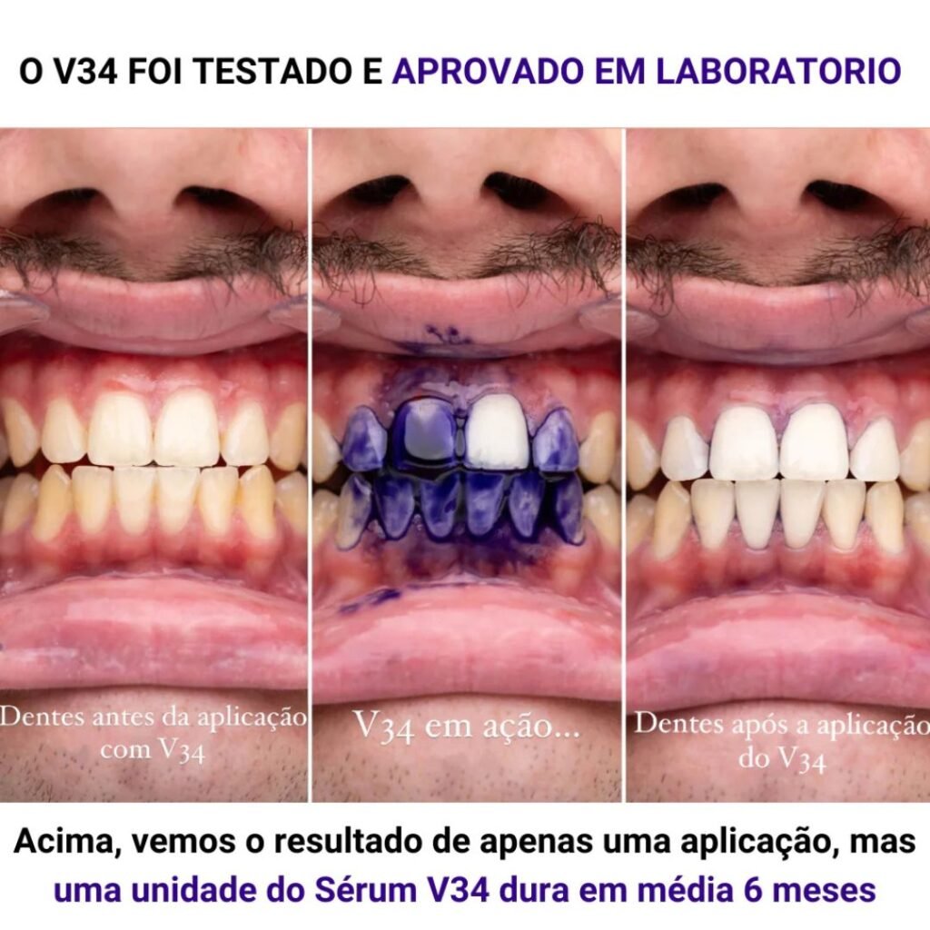 Tiras clareadora dental v34 funciona? Minha experiência