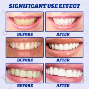Adesivos 5D branqueador de dentes: Original 5D Tech