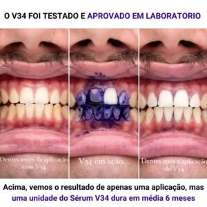 Fita roxa clareadora dental: Tiras Clareadoras de Dentes Roxas 14 Unidades
